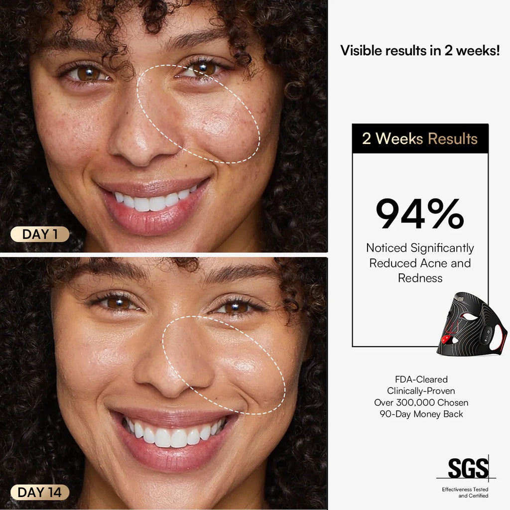 INIA GLOW Wireless Red Light Therapy Mask
