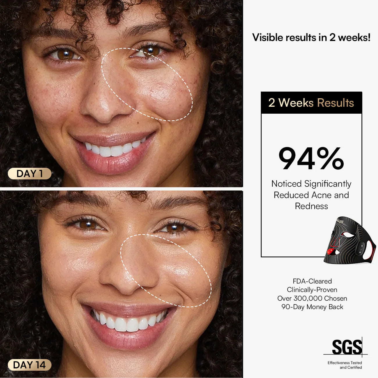 INIA GLOW Wireless Red Light Therapy Mask