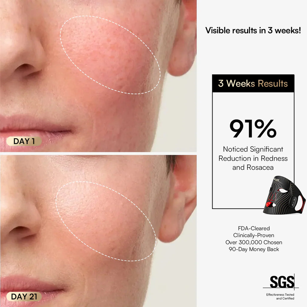 INIA GLOW Wireless Red Light Therapy Mask