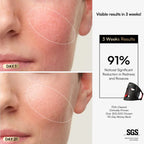 INIA GLOW Wireless Red Light Therapy Mask