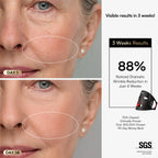 INIA GLOW Wireless Red Light Therapy Mask